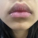 유채약국 | 겨울철 립밤 고르는 법 촉촉함 오래가는 립밤 성분과 실제 사용 후기