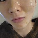 아람 바이오시스템(주) | 부천 코코스킨앤바디 후기 코·나비존 바이오리필 받고 피부가 환해졌어요!