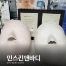 돈 아깝지 않았던 아깝지 않은 성북구 민스킨앤바디 윤곽축소 관리 후기