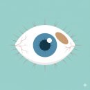 서대구안과의원 | 대구 수성구 아이굿안과 / 안과 정기검진, 결막모반(눈점) 잘하는 곳, 레이저 제거 후기