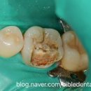 부여치과기공소 이미지