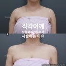 제니성형외과의원 | 제니·닝닝의 직각어깨, 사실 필러로 만들 수 있다? 성형외과 전문의가 직접 시술해야 하는 이유