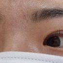 블링아이즈 이미지
