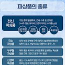 파상풍 초기 , 파상풍주사 예방접종 기간 병원 비용 이미지