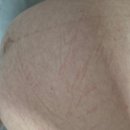 진형 | 산본 제일병원 진형수 부원장님 역아회전술 성공 후기 및 비용(36주 차 3일)