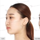 제이케이성형외과의원 이미지