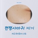 연세클리어의원 | 배곧 연세클리어의원 - 편평사마귀 제거 (내돈내산) / 예비신부 피부관리