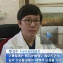 황성주털털 모발이식병원,여름철 탈모관리 (KBS뉴스광장) 이미지