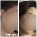 조이스킨 | 잠실피부관리 추천♡ 석촌역 피부관리샵<조이스킨앤스파> 후기♡