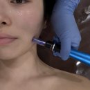 밀라노에스테틱 | 구미 피부관리 미노브 에스테틱 스킨부스터 관리 효과 후기 구미 웨딩관리 여드름관리