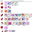 Poikilocyte (포이키로싸이트, 변형적혈구) 이미지
