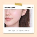 온다메드 | 인천송도피부과 잘하는곳 레비나스 브이로 온다 리프팅 통증 솔직후기