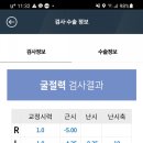 곽안과의원 | 강남 이오스 안과 투데이라섹 오정우원장님 검안 솔직 후기 / 가격 정보 공유