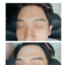 수아미에스테틱 | 강남 남자눈썹 잘하는곳 수아미 에스테틱 :: 자연눈썹후기