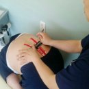 생활 건강 테이핑 이미지