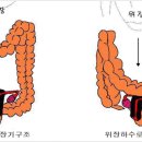 가스실금(만성 방귀)에 대한 고찰 이미지