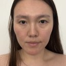 양산 수기 관리 양산 다올뷰티 에스테틱 얼굴관리 후기