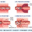산소로 이미지