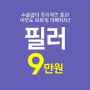 수지필러 이마필러후기