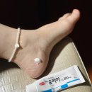 태선약국 | 유리아 우레아 크림 약국 피부연화제 풋크림 각질제거...건조 주부습진 등 효과 내돈내산 실제 사용 후기