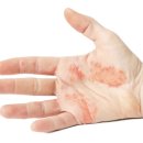 은평우태하피부과의원 이미지