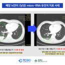 티시바이오 이미지