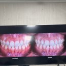 덴탈스케치치과기공소 | #004 이은혁원장님 덴탈포토 특강 (24.05.25)