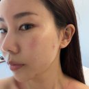 밝음메디 이미지