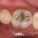 네츄럴치과기공소 이미지