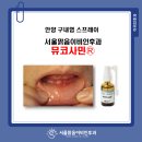 청솔치과의원 | 안양이비인후과, 뮤코사민 스프레이 구내염