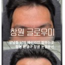 미헤어라인 | 창원남자헤어라인 잘하는곳 글로우미 창원상남 솔직 방문 후기