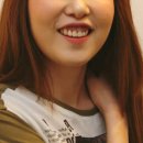 손거미 | 거미스마일 보톡스, 잇몸성형 후기. 6곳 상담 후 내린 결론