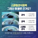 아이러브안과의원 | 압구정역 아이러브안과, 내돈내산 스마일라식 10일차 후기 (+수술절차, 비용, 주의점)