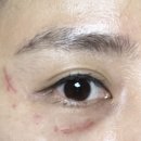 서초 서울 마더스 이미지