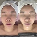 4927 | 비전동피부관리 찾는다면? 바디채움빚다에서 윤곽관리 받고 만족한 후기