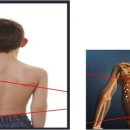 척추/골반/재활[척추 수술/시술 판정 및 재발하신 분.. 허리(목) 디스크, 척추 협착증..] & 보디빌딩(Body building) 1:1 맞춤 운동 & 주식 강의 전문 이미지