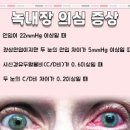 눈침침 백내장 녹내장 증상 치료 이미지