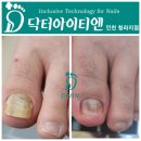 위드유네일