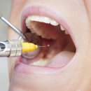 목포예치과의원 | [목포예치과]당신이 믿고 있는 치과 상식, 정말 맞을까?#1편