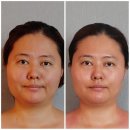 WR(서울특별시 양천구)-[지양로]-하-2 | 양천구 피부관리 전문점 에스테티아 신월1호점에서 관리받고 온 방문기