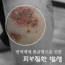 고운누리피부과