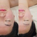 물오른피부 - 달서구 조암로 38 | 경산 문제성피부 웨딩관리 대만족 물오른피부 경산점 내돈내산 후기