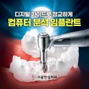 풍무올치과의원 | 풍무역치과 임플란트오래 쓰려면 꼭 확인하세요