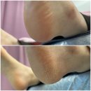 [천안 발각질제거][신방동 통정패디플래닝] 강연우뷰티 방문후기