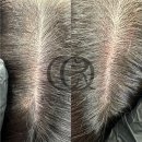 채오름SMP 이미지