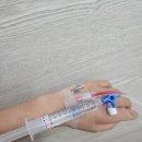 유방5통 이미지