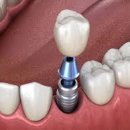 다소치과기공소 이미지