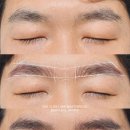 라이모플러스(LYMOPLUS) 이미지