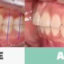 베스티스치과의원 이미지