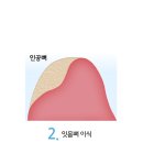 at센터 맞은편 이미지